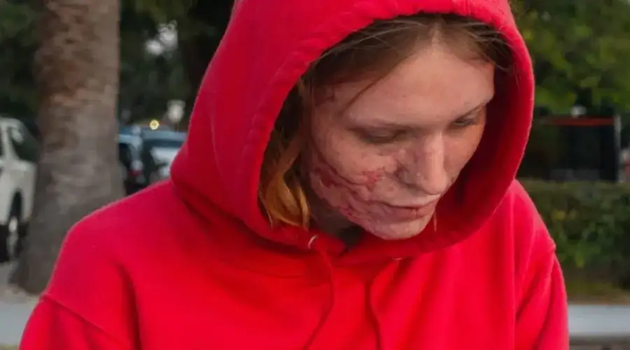 Malade de moi-même - Perturbant et hilarant à parts égales